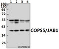 Western blot (WB) analysis of COPS5/JAB1 (K191) pAb at 1:1000 dilution
Lane1:A549 whole cell lysate(40ug)
Lane2:MCF-7 whole cell lysate(40ug)
Lane3:The Lung tissue lysate of Rat(40ug)
Lane4:CT26 whole cell lysate(40ug)
