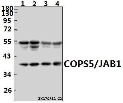 Western blot (WB) analysis of COPS5/JAB1 (K191) pAb at 1:1000 dilution
Lane1:A549 whole cell lysate(40ug)
Lane2:MCF-7 whole cell lysate(40ug)
Lane3:The Lung tissue lysate of Rat(40ug)
Lane4:CT26 whole cell lysate(40ug)