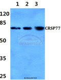 CRSP77 (V171) polyclonal antibody – Figure 1 of 1