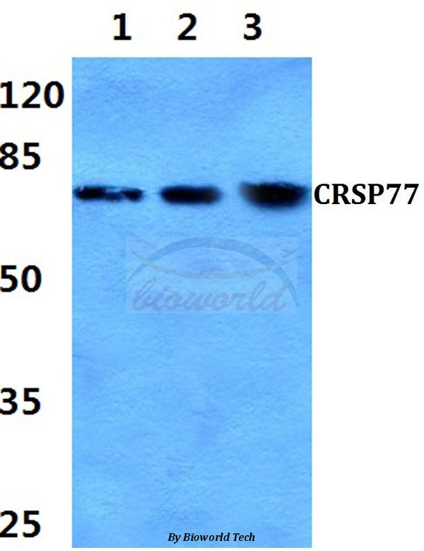 CRSP77 (V171) polyclonal antibody – Figure 1 of 1
