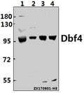 Western blot (WB) analysis of Dbf4 (I18) pAb at 1:500 dilution
Lane1:HEK293T whole cell lysate(40ug)
Lane2:PC3 whole cell lysate(40ug)
Lane3:The Testis tissue lysate of Mouse(40ug)
Lane4:The Testis tissue lysate of Rat(40ug)