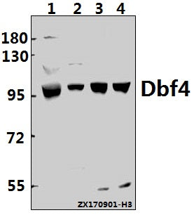 Western blot (WB) analysis of Dbf4 (I18) pAb at 1:500 dilution
Lane1:HEK293T whole cell lysate(40ug)
Lane2:PC3 whole cell lysate(40ug)
Lane3:The Testis tissue lysate of Mouse(40ug)
Lane4:The Testis tissue lysate of Rat(40ug)