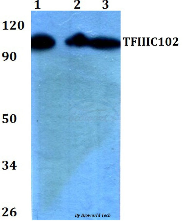 TFIIIC102 (E131) polyclonal antibody – Figure 1 of 1