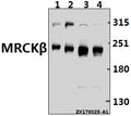 Western blot (WB) analysis of MRCKβ (F1665) pAb at 1:500 dilution
Lane1:The Brain tissue lysate of Mouse(40ug)
Lane2:The Brain tissue lysate of Rat(40ug)
Lane3:A549 whole cell lysate(40ug)
Lane4:MCF-7 whole cell lysate(40ug)
