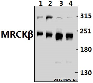 Western blot (WB) analysis of MRCKβ (F1665) pAb at 1:500 dilution
Lane1:The Brain tissue lysate of Mouse(40ug)
Lane2:The Brain tissue lysate of Rat(40ug)
Lane3:A549 whole cell lysate(40ug)
Lane4:MCF-7 whole cell lysate(40ug)