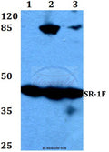SR-1F (T126) polyclonal antibody – Figure 1 of 1