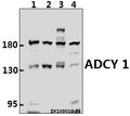 Western blot (WB) analysis of ADCY 1 (D252) Antibody at 1:500 dilution
Lane1:HEK293T whole cell lysate(40ug)
Lane2:MCF-7 whole cell lysate(40ug)
Lane3:C6 whole cell lysate(40ug)
Lane4:AML-12 whole cell lysate(40ug)