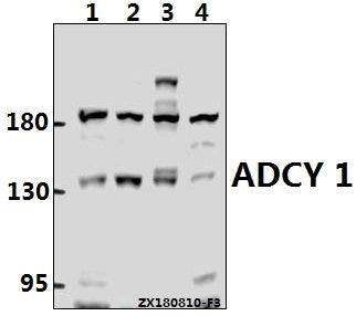 Western blot (WB) analysis of ADCY 1 (D252) Antibody at 1:500 dilution
Lane1:HEK293T whole cell lysate(40ug)
Lane2:MCF-7 whole cell lysate(40ug)
Lane3:C6 whole cell lysate(40ug)
Lane4:AML-12 whole cell lysate(40ug)