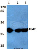 AIM2 (A78) polyclonal antibody - Figure 1 of 1