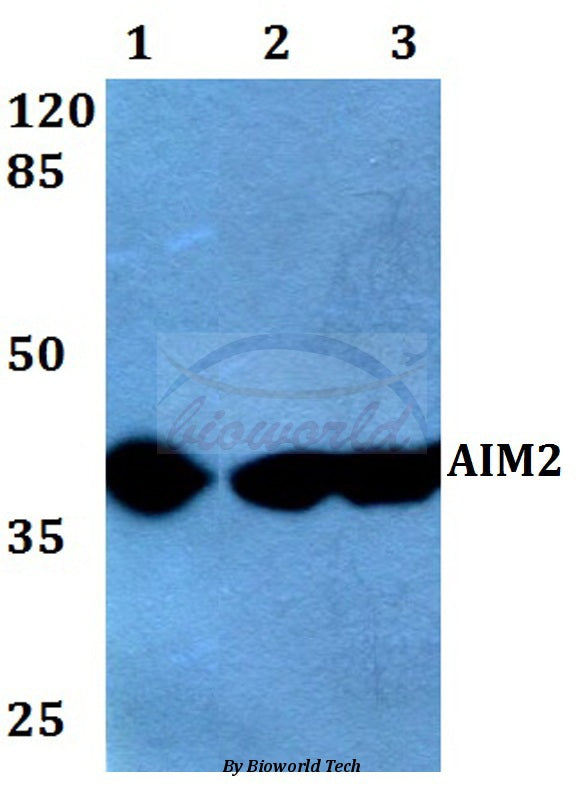 AIM2 (A78) polyclonal antibody - Figure 1 of 1