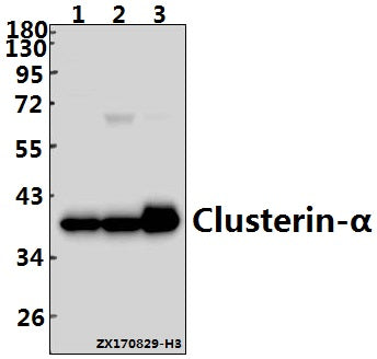 Western blot (WB) analysis of Clusterin-α (E436) pAb at 1:500 dilution
Lane1:Hela whole cell lysate(40ug)
Lane2:A549 whole cell lysate(40ug)
Lane3:SGC7901 whole cell lysate(40ug)