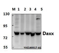 Western blot (WB) analysis of Daxx (D384) polyclonal antibody at 1:500 dillution
Lane1:Hela whole cell lysate(40μg)
Lane2:MCF-7 whole cell lysate(40μg) 
Lane3:A549 whole cell lysate(40μg)
Lane4:PC12 whole cell lysate(40μg) 
Lane5:The Brain tissue lysate of Mouse (40μg)