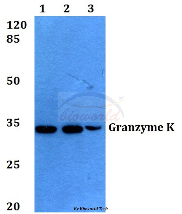Granzyme K (H85) polyclonal antibody – Figure 1 of 1