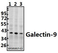 Western blot (WB) analysis of Galectin-9 (G80) pAb at 1:500 dilution
Lane1:K562 whole cell lysate(40ug)
Lane2:Myla2059 whole cell lysate(40ug)
Lane3:HCT116 whole cell lysate(40ug)