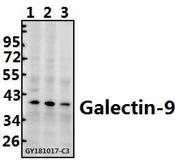 Western blot (WB) analysis of Galectin-9 (G80) pAb at 1:500 dilution
Lane1:K562 whole cell lysate(40ug)
Lane2:Myla2059 whole cell lysate(40ug)
Lane3:HCT116 whole cell lysate(40ug)