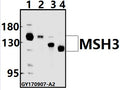 Western blot (WB) analysis of MSH3 (A80) pAb at 1:500 dilution
Lane1:HEK293T whole cell lysate(20ug)
Lane2:MCF-7 whole cell lysate(20ug)
Lane3:H9C2 whole cell lysate(20ug)
Lane4:CT26 whole cell lysate(40ug)