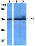 Western blot (WB) analysis of NF-YC (W85) polyclonal antibody at 1:500 dilution
Lane1:HEK293T whole cell lysate
Lane2:Raw264.7 whole cell lysate
Lane3:H9C2 whole cell lysate