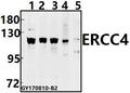 Western blot (WB) analysis of ERCC4 (A822) pAb at 1:500 dilution
Lane1:HEK293T whole cell lysate(40ug)
Lane2:MCF-7 whole cell lysate(40ug)
Lane3:U-87MG whole cell lysate(40ug)
Lane4:C6 whole cell lysate(40ug)
Lane5:CT26 whole cell lysate(40ug)