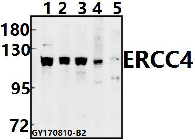 Western blot (WB) analysis of ERCC4 (A822) pAb at 1:500 dilution
Lane1:HEK293T whole cell lysate(40ug)
Lane2:MCF-7 whole cell lysate(40ug)
Lane3:U-87MG whole cell lysate(40ug)
Lane4:C6 whole cell lysate(40ug)
Lane5:CT26 whole cell lysate(40ug)