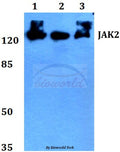 Western blot (WB) analysis of JAK2 (R564) polyclonal antibody at 1:500 dilution
LaneA:Jurkat whole cell lysate
LaneB:K562 whole cell lysate
LaneC:HEK293T whole cell lysate