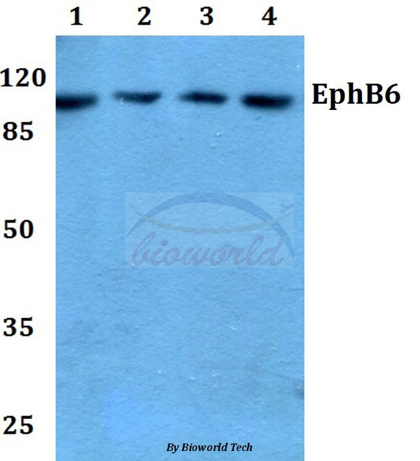 Western blot (WB) analysis of EphB6 (D881) polyclonal antibody at 1:500 dilution
Lane1:Hela whole cell lysate
Lane2:NIH-3T3 whole cell lysate
Lane3:PC12 whole cell lysate
Lane4:H9C2 whole cell lkysate