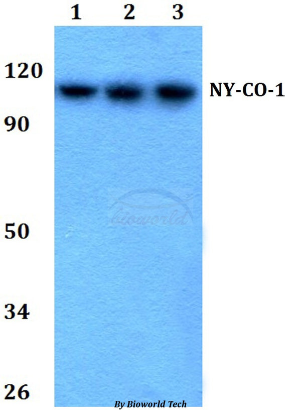 Western blot (WB) analysis of NY-CO-1 (K914) polyclonal antibody at 1:500 dilution
Lane1:HEK293T whole cell lysate
Lane2:Raw264.7 whole cell lysate
Lane3:PC12 whole cell lysate