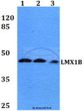 Western blot (WB) analysis of LMX1B (D159) polyclonal antibody at 1:500 dilution
Lane1:HEK293T whole cell lysate
Lane2:Raw264.7 whole cell lysate
Lane3:PC12 whole cell lysate