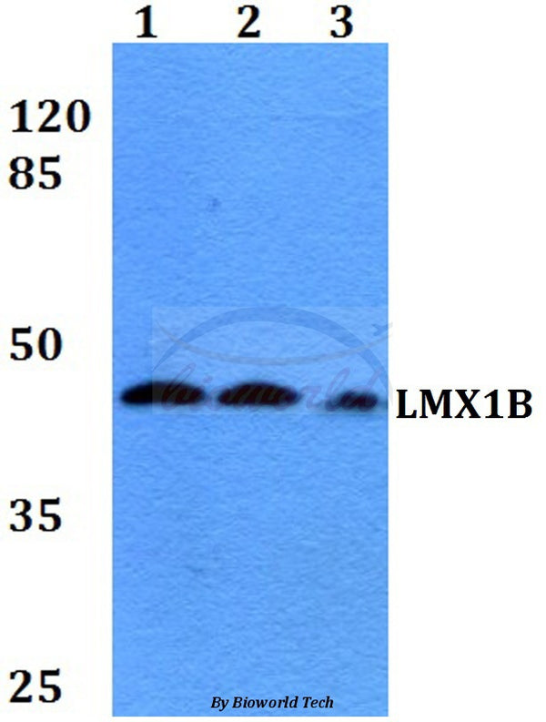 Western blot (WB) analysis of LMX1B (D159) polyclonal antibody at 1:500 dilution
Lane1:HEK293T whole cell lysate
Lane2:Raw264.7 whole cell lysate
Lane3:PC12 whole cell lysate