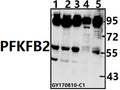 Western blot (WB) analysis of PFKFB2 (Y14) pAb at 1:500 dilution
Lane1:A549 whole cell lysate(40ug)
Lane2:PC3 whole cell lysate(40ug)
Lane3:MCF-7 whole cell lysate(40ug)
Lane4:Hela whole cell lysate(40ug)
Lane5:U-87MG whole cell lysate(40ug)