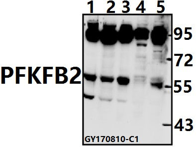 Western blot (WB) analysis of PFKFB2 (Y14) pAb at 1:500 dilution
Lane1:A549 whole cell lysate(40ug)
Lane2:PC3 whole cell lysate(40ug)
Lane3:MCF-7 whole cell lysate(40ug)
Lane4:Hela whole cell lysate(40ug)
Lane5:U-87MG whole cell lysate(40ug)