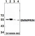 Western blot (WB) analysis of EMMPRIN (Q370) polyclonal antibody at 1:500 dillution
Lane1:HEK293T whole cell lysate
Lane2:DLD whole cell lysate
Lane3:The fetal heart tissue lysate of Mouse
Lane4:The fetal heart tissue lysate of Rat