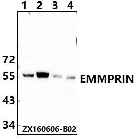 Western blot (WB) analysis of EMMPRIN (Q370) polyclonal antibody at 1:500 dillution
Lane1:HEK293T whole cell lysate
Lane2:DLD whole cell lysate
Lane3:The fetal heart tissue lysate of Mouse
Lane4:The fetal heart tissue lysate of Rat