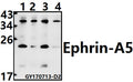 Western blot (WB) analysis of Ephrin-A5 (P63) polyclonal antibody at 1:500 dilution
Lane1:A549 whole cell lysate(40ug)
Lane2:MCF-7 whole cell lysate(40ug)
Lane3:CT26 whole cell lysate(40ug)
Lane4:H9C2 whole cell lysate(40ug)