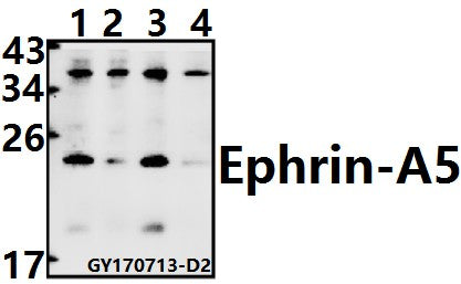 Western blot (WB) analysis of Ephrin-A5 (P63) polyclonal antibody at 1:500 dilution
Lane1:A549 whole cell lysate(40ug)
Lane2:MCF-7 whole cell lysate(40ug)
Lane3:CT26 whole cell lysate(40ug)
Lane4:H9C2 whole cell lysate(40ug)