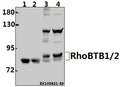 Western blot (WB) analysis of RhoBTB1/2 (T85) pAb at 1:1000 dilution
Lane1:The Kidney tissue lysate of Mouse(40ug)
Lane2:The Kidney tissue lysate of Rat(40ug)
Lane3:U-87MG whole cell lysate(40ug)
Lane4:Hela whole cell lysate(40ug)