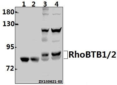 Western blot (WB) analysis of RhoBTB1/2 (T85) pAb at 1:1000 dilution
Lane1:The Kidney tissue lysate of Mouse(40ug)
Lane2:The Kidney tissue lysate of Rat(40ug)
Lane3:U-87MG whole cell lysate(40ug)
Lane4:Hela whole cell lysate(40ug)