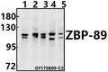 Western blot (WB) analysis of ZBP-89 (E84) at 1:500 dilution
Lane1:H9C2 whole cell lysate(40ug)
Lane2:SP2/0 whole cell lysate(40ug)
Lane3:Hela whole cell lysate(40ug)
Lane4:HEK293T whole cell lysate(40ug)
Lane5:U-87MG whole cell lysate(40ug)