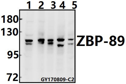 Western blot (WB) analysis of ZBP-89 (E84) at 1:500 dilution
Lane1:H9C2 whole cell lysate(40ug)
Lane2:SP2/0 whole cell lysate(40ug)
Lane3:Hela whole cell lysate(40ug)
Lane4:HEK293T whole cell lysate(40ug)
Lane5:U-87MG whole cell lysate(40ug)