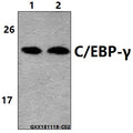 Western blot (WB) analysis of C/EBP-γ (E64) polyclonal antibody at 1:500 dilution
Lane1:SGC-7901 whole cell lysate(40ug)
Lane2:The testis tissue lysate of Mouse(30ug)
