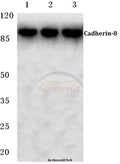 Western blot (WB) analysis of Cadherin-8 (A519) polyclonal antibody at 1:500 dilution
Lane1:Hela cell lysate
Lane2:Mouse liver tissue lysate
Lane3:Rat liver tissue lysate