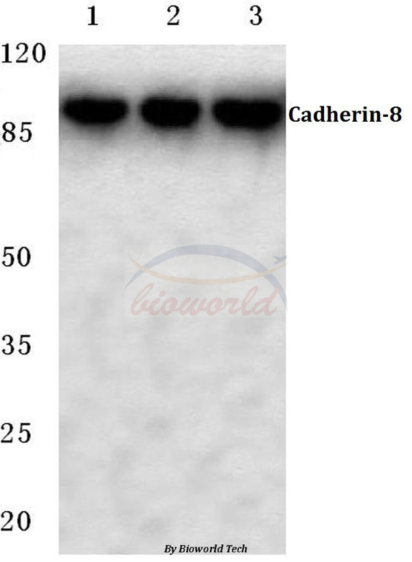 Western blot (WB) analysis of Cadherin-8 (A519) polyclonal antibody at 1:500 dilution
Lane1:Hela cell lysate
Lane2:Mouse liver tissue lysate
Lane3:Rat liver tissue lysate