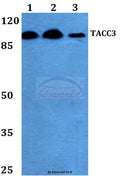 TACC3 (T813) polyclonal antibody – Figure 1 of 1
