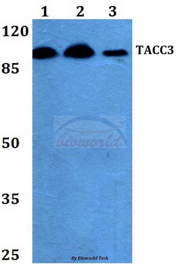 TACC3 (T813) polyclonal antibody – Figure 1 of 1