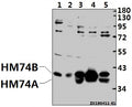 Western blot (WB) analysis of GPR109B pAb at 1:500 dilution
Lane1:PMVEC whole cell lysate(40ug)
Lane2:SP2/0 whole cell lysate(40ug)
Lane3:A549 whole cell lysate(40ug)
Lane4:Myla2059 whole cell lysate(40ug)
Lane5:MCF-7 whole cell lysate(40ug)