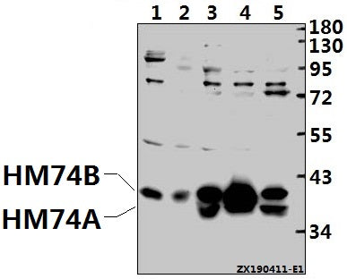 Western blot (WB) analysis of GPR109B pAb at 1:500 dilution
Lane1:PMVEC whole cell lysate(40ug)
Lane2:SP2/0 whole cell lysate(40ug)
Lane3:A549 whole cell lysate(40ug)
Lane4:Myla2059 whole cell lysate(40ug)
Lane5:MCF-7 whole cell lysate(40ug)