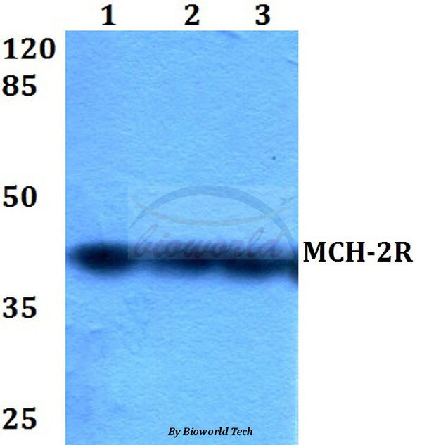 MCH-2R (M332) polyclonal antibody – Figure 1 of 1
