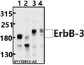 Western blot (WB) analysis of ErbB-3 (D1324) pAb at 1:500 dilution
Lane1:MCF-7 whole cell lysate(40ug)
Lane2:PC3 whole cell lysate(40ug)
Lane3:PC12 whole cell lysate(40ug)
Lane4:AML-12 whole cell lysate(40ug)