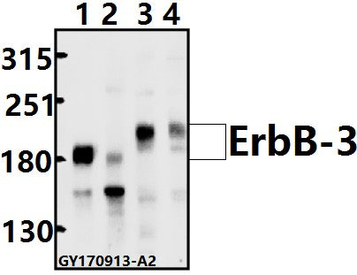 Western blot (WB) analysis of ErbB-3 (D1324) pAb at 1:500 dilution
Lane1:MCF-7 whole cell lysate(40ug)
Lane2:PC3 whole cell lysate(40ug)
Lane3:PC12 whole cell lysate(40ug)
Lane4:AML-12 whole cell lysate(40ug)