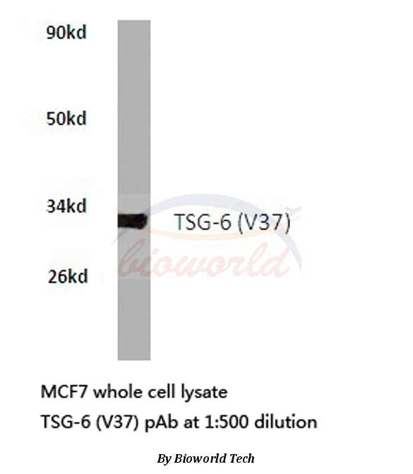 Western blot (WB) analysis of TSG-6 (V37) polyclonal antibody in extracts from MCF7 cells.