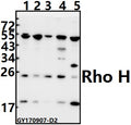 Western blot (WB) analysis of Rho H (M134) pAb at 1:500 dilution
Lane1:HEK293T whole cell lysate(20ug)
Lane2:HepG2 whole cell lysate(20ug)
Lane3:Hela whole cell lysate(20ug)
Lane4:C6 whole cell lysate(40ug)
Lane5:CT26 whole cell lysate(40ug)